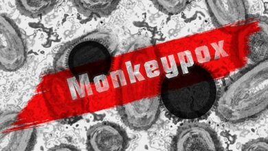 The most important information you need to know about monkeypox 2022